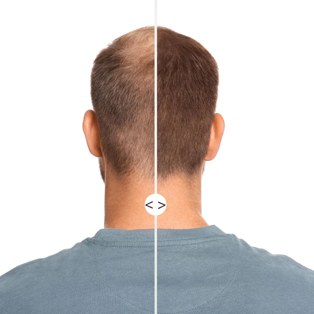 Routine cheveux clairsemés : Fond de Cheveux + Applicateur Kabuki - Image 10